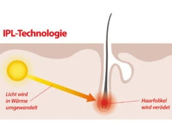Sichler Beauty Laser Haarentferner:IPL-Haarentfernungs-System, 2 Aufsätze, Display, 5 Stufen,Schutzbrille 18 Sichler Beauty Laser Haarentferner:IPL-Haarentfernungs-System, 2 Aufsätze, Display, 5 Stufen,Schutzbrille -Newgen medicals Shop nx3068 12