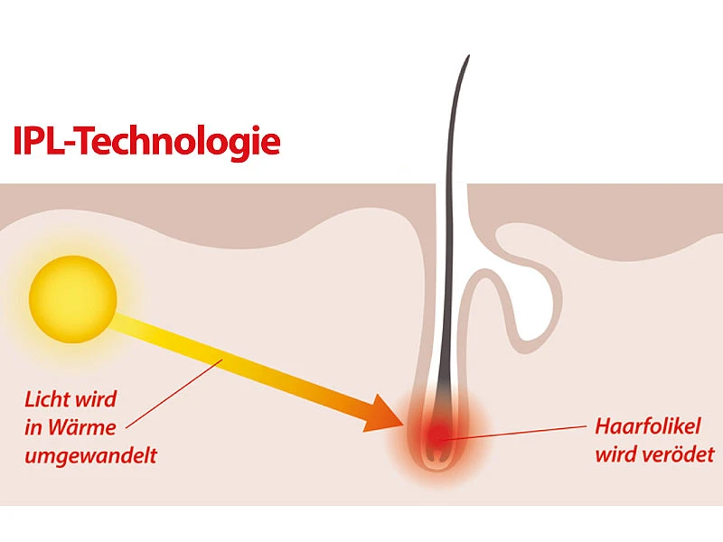 Sichler Beauty Laser Haarentferner:IPL-Haarentfernungs-System, 2 Aufsätze, Display, 5 Stufen,Schutzbrille 7 Sichler Beauty Laser Haarentferner:IPL-Haarentfernungs-System, 2 Aufsätze, Display, 5 Stufen,Schutzbrille – Bild 7