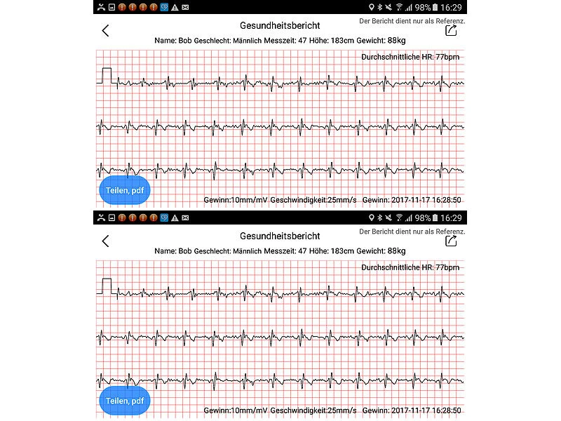 Newgen Medicals Uhr Mit EKG:Fitness-Armband, Blutdruck-& Herzfrequenz-Anzeige (Versandrückläufer) 6 Newgen Medicals Uhr Mit EKG:Fitness-Armband, Blutdruck-& Herzfrequenz-Anzeige (Versandrückläufer) – Bild 6