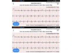 Newgen Medicals Uhr Mit Blutdruckanzeige:Fitness-Armband Mit Blutdruck-, Herzfrequenz- Und EKG-Anzeige, IP67 18 Newgen Medicals Uhr Mit Blutdruckanzeige:Fitness-Armband Mit Blutdruck-, Herzfrequenz- Und EKG-Anzeige, IP67 -Newgen medicals Shop nx4393 22