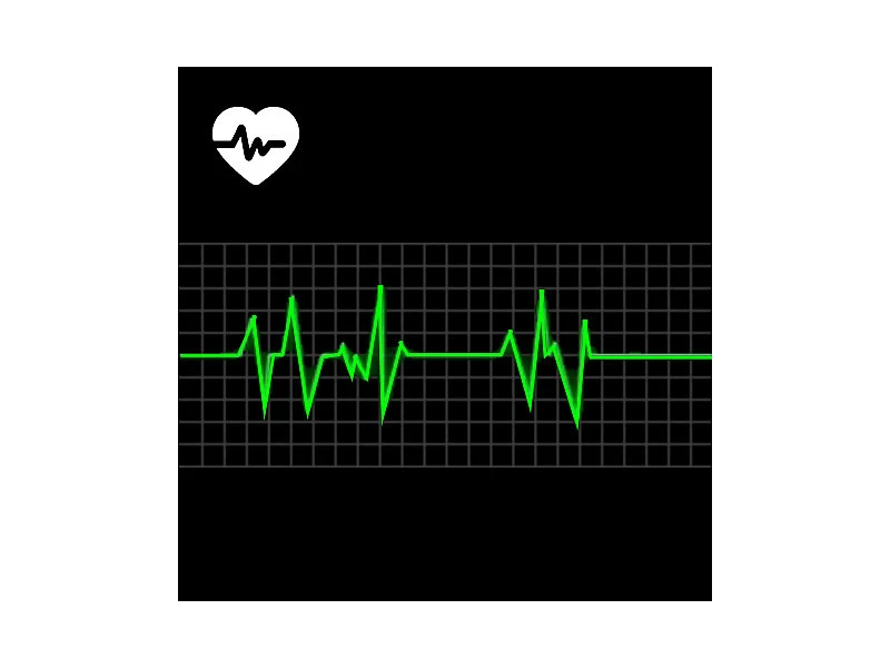 Newgen Medicals Gesundheitsuhr Mit EKG:Fitness-Uhr Mit EKG- & Blutdruckanzeige, Versandrückläufer 11 Newgen Medicals Gesundheitsuhr Mit EKG:Fitness-Uhr Mit EKG- & Blutdruckanzeige, Versandrückläufer – Bild 11